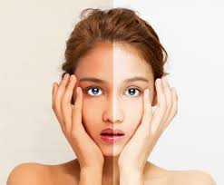 Beyond Whitening: Pendekatan Ilmiah Synlotic Biotech untuk Kulit Lebih Cerah dan Warna Merata